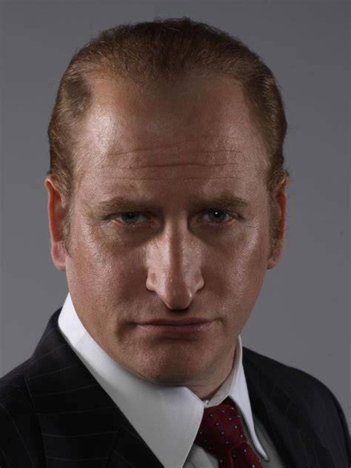 Lachy Hulme had plastic surgery to play Kerry Packer